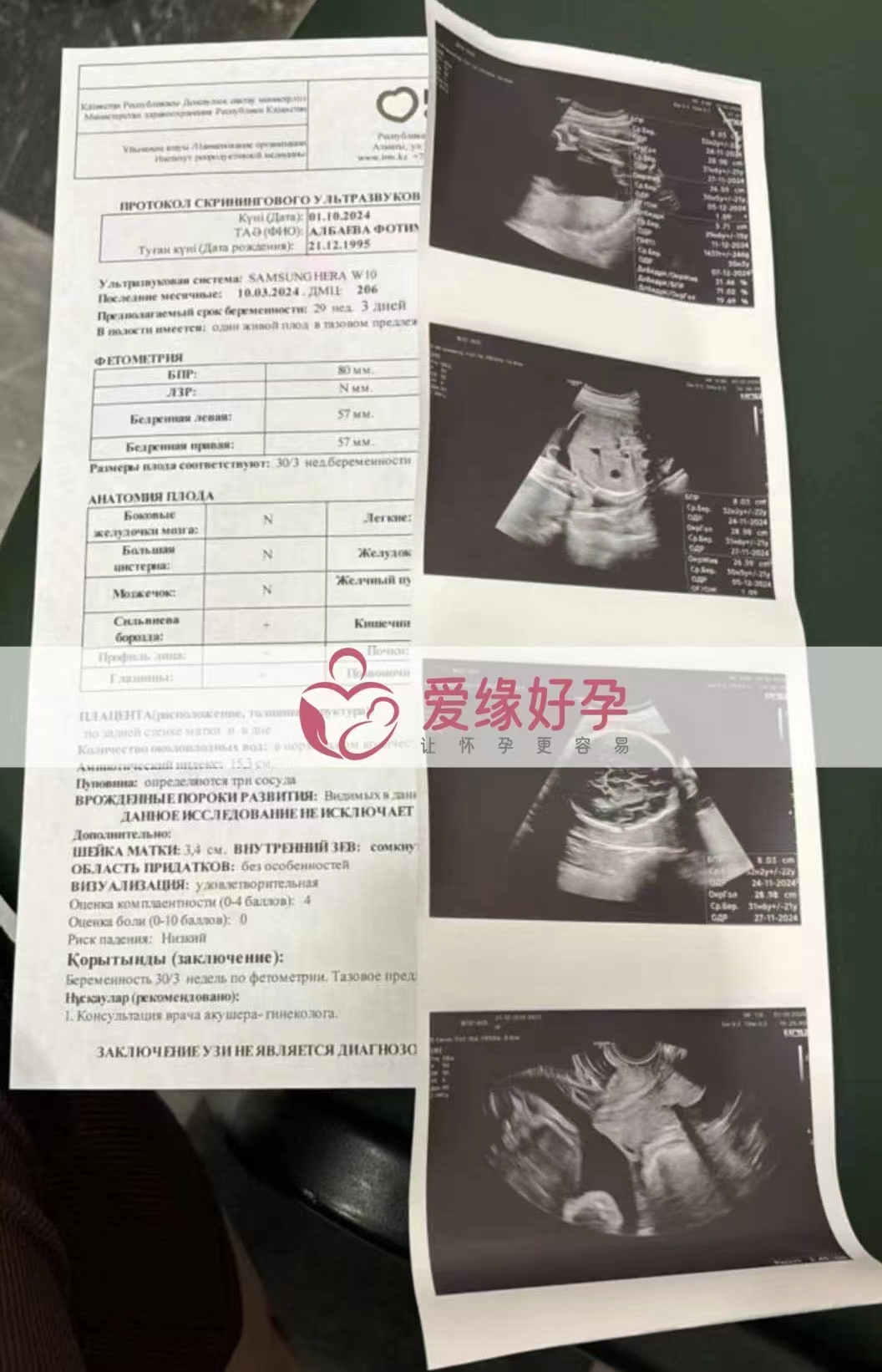 哈萨克斯坦代孕代母孕29周产检顺利通过