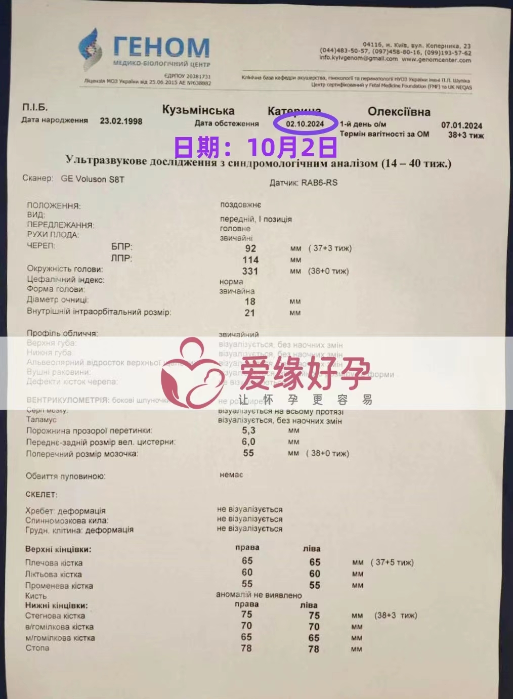 乌克兰代孕代母孕28周产检顺利通过