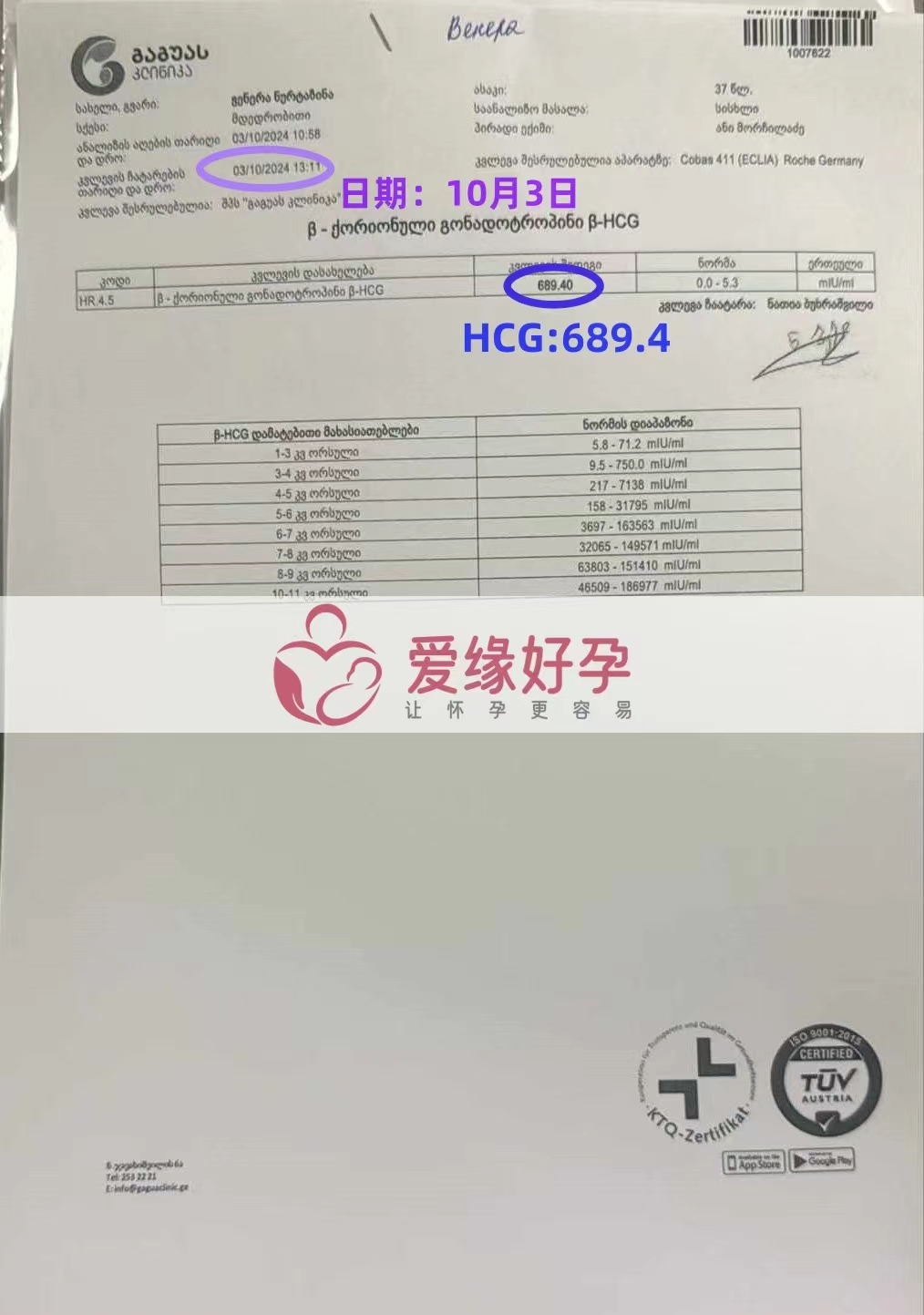 格鲁吉亚代孕代母，宝宝顺利着床成功，HCG血值689