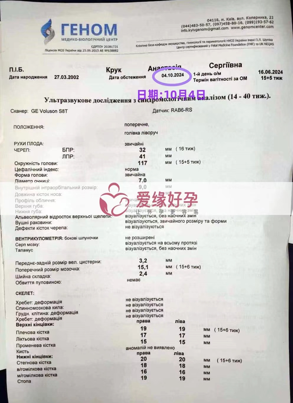 乌克兰代孕代母孕16周产检顺利通过