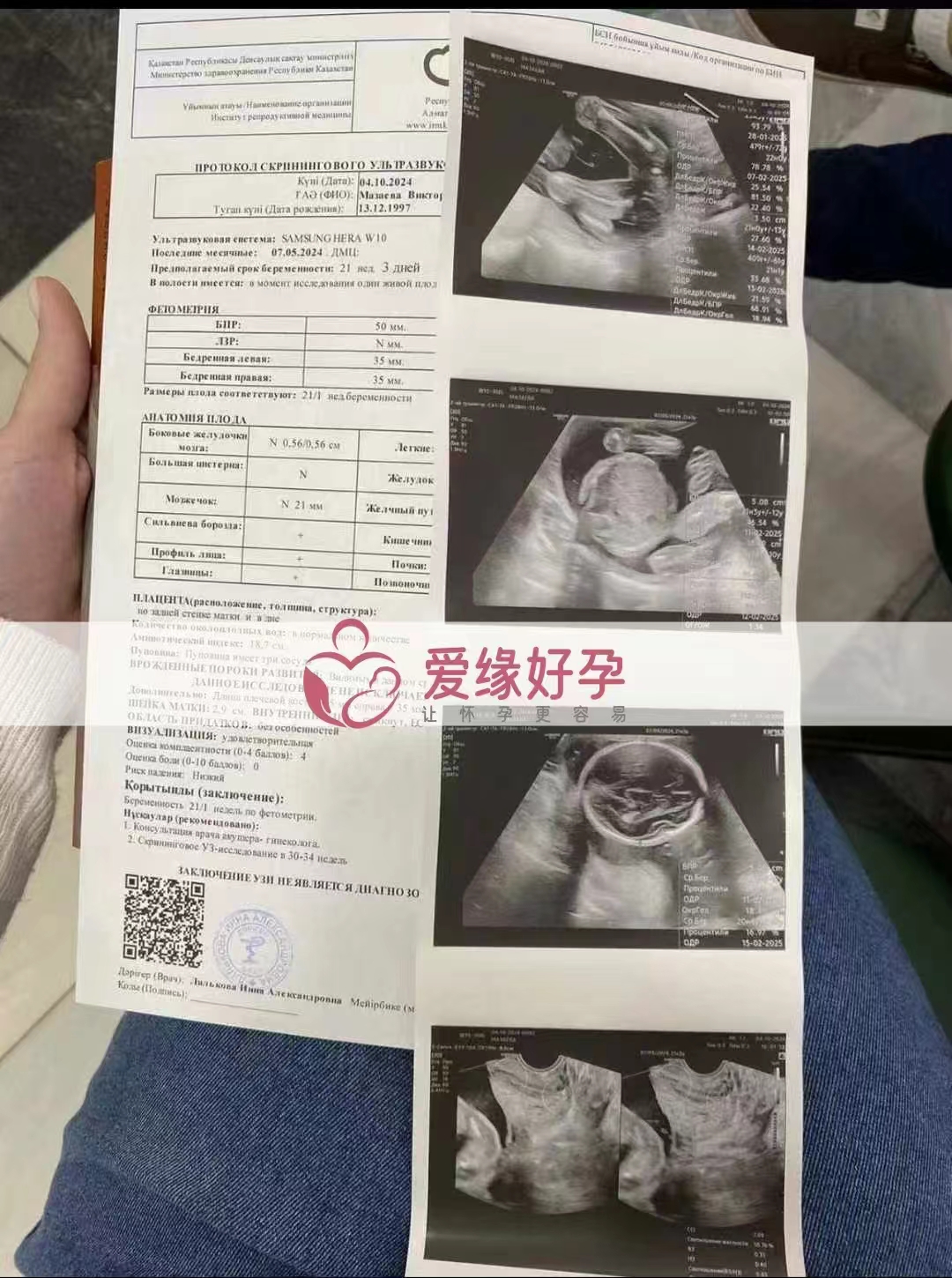 哈萨克斯坦代孕代母孕21周产检顺利通过