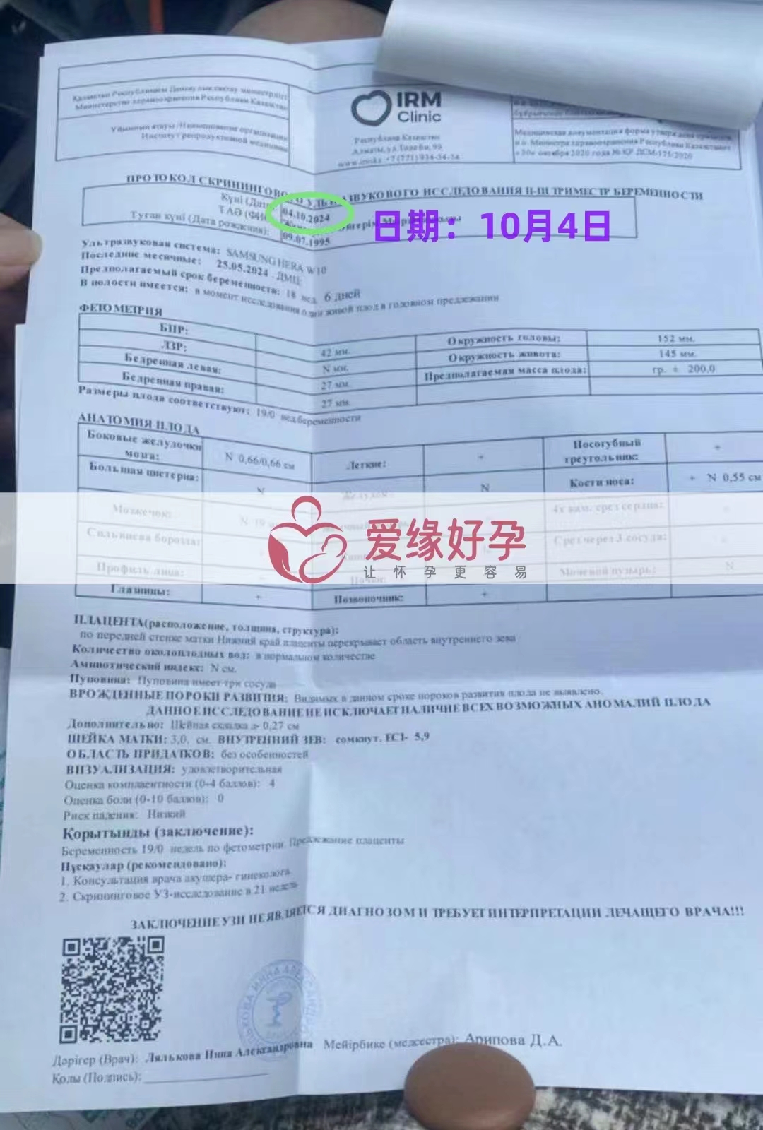 哈萨克斯坦代孕代母孕18周产检顺利通过