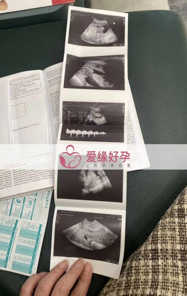 哈萨克斯坦代孕代母孕18周产检顺利通过