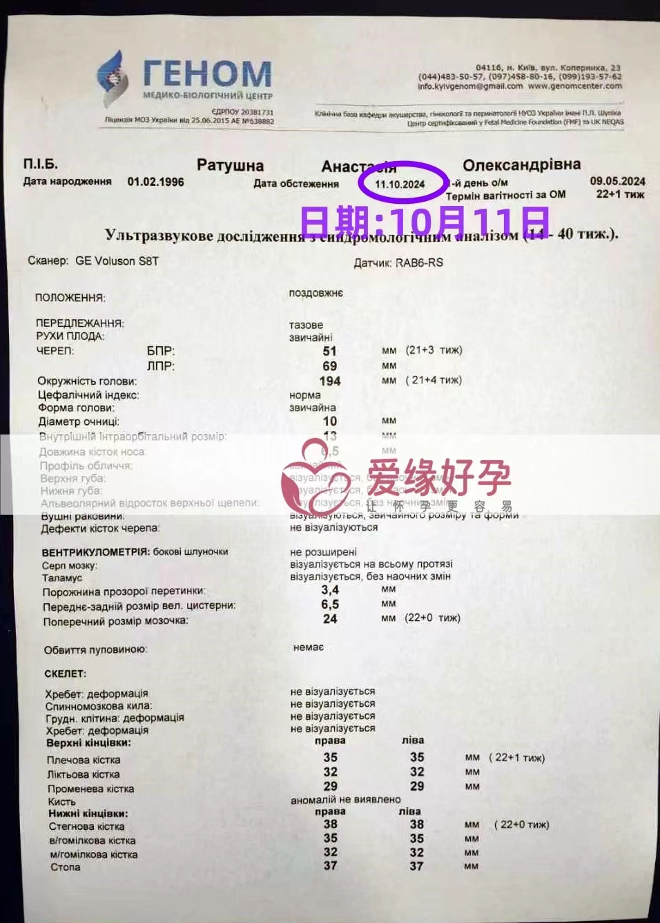 乌克兰代孕代母孕22周产检顺利通过