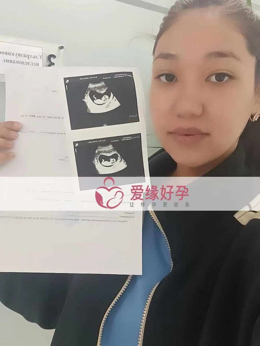 哈萨克斯坦代孕代母孕13周产检顺利通过