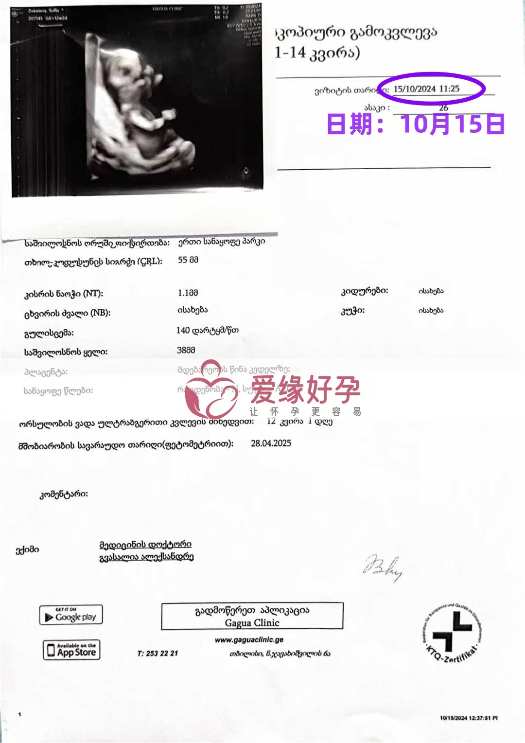 格鲁吉亚代孕代母孕12周产检顺利通过