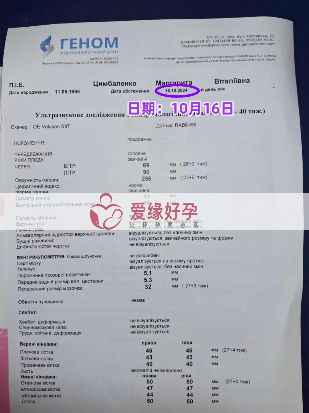 乌克兰代孕代母孕27周产检顺利通过