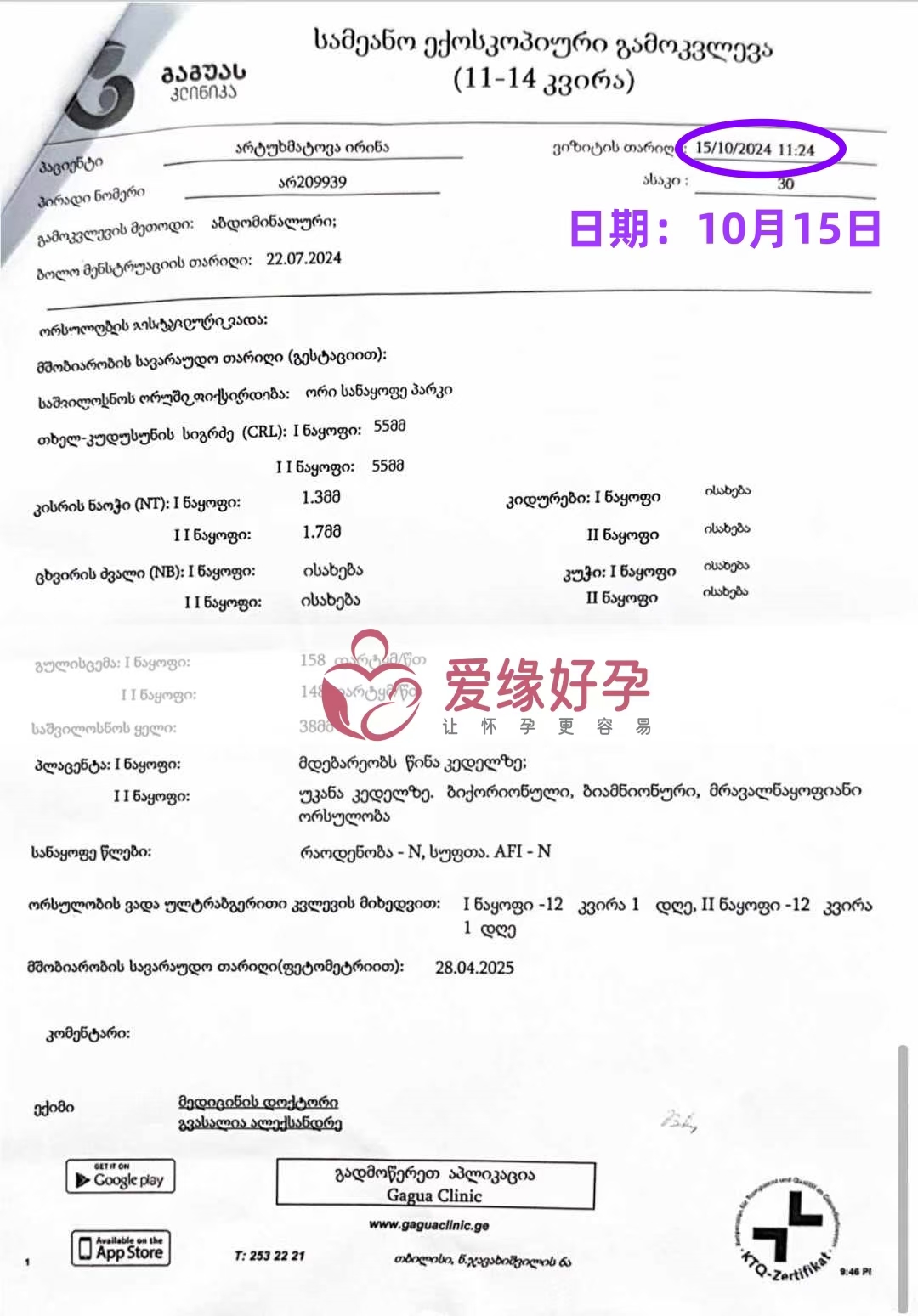 格鲁吉亚代孕代母双胞胎孕12周产检顺利通过