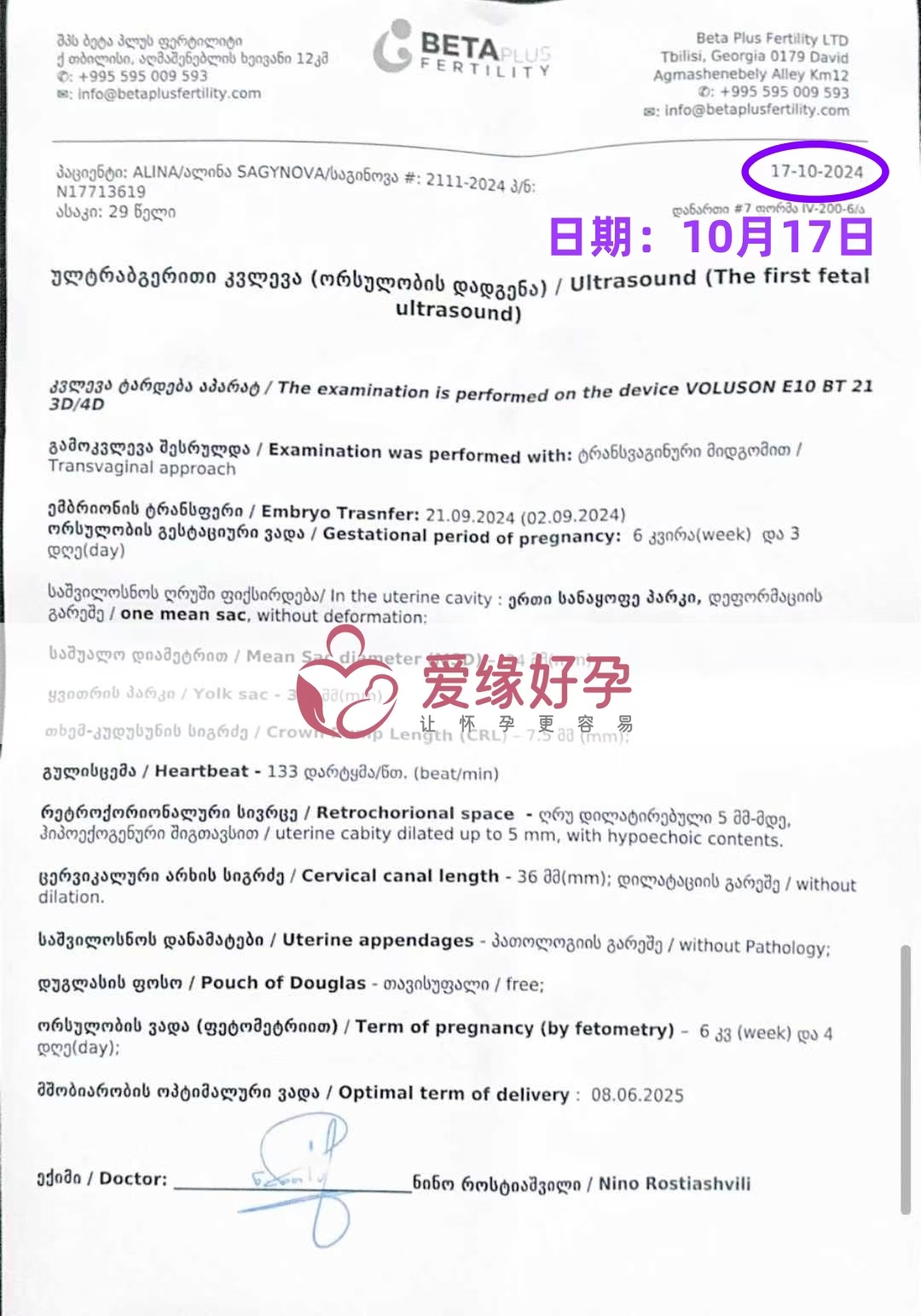 格鲁吉亚代孕代母孕6周产检顺利通过