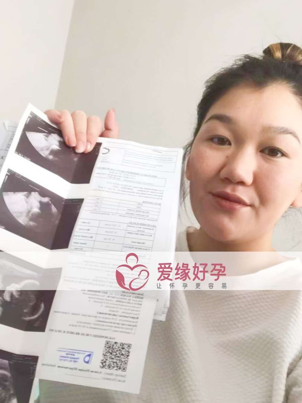 哈萨克斯坦代孕代母孕21周产检顺利通过