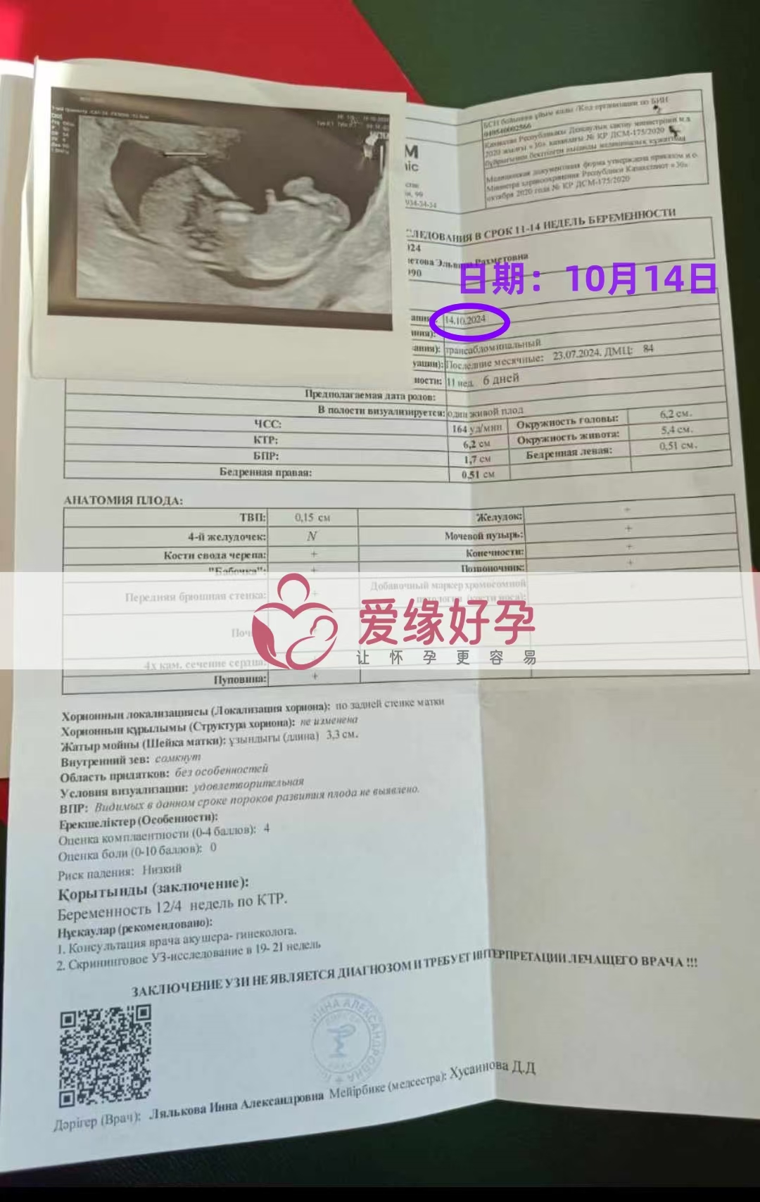 哈萨克斯坦代孕代母孕12周产检顺利通过