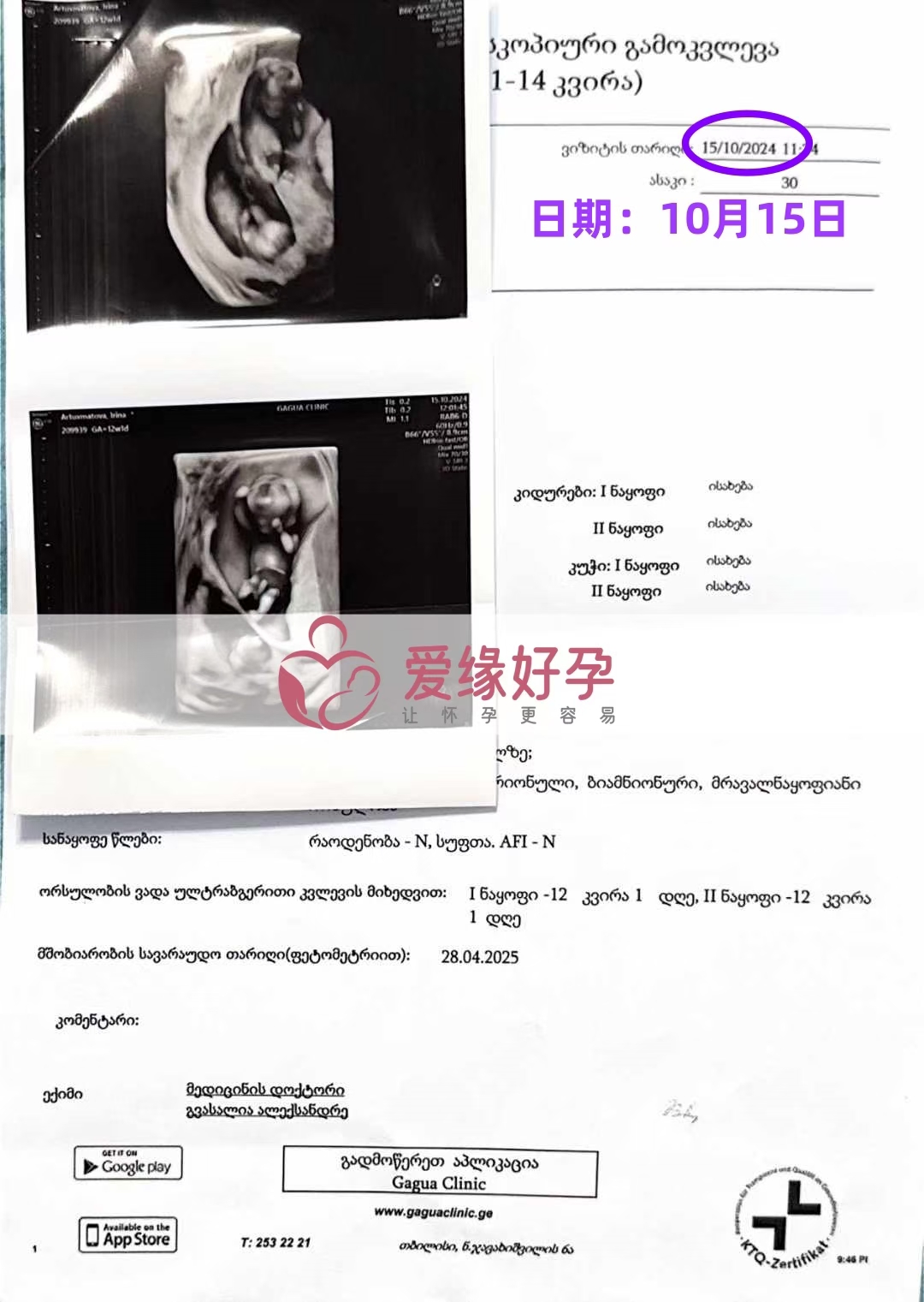 格鲁吉亚代孕代母双胞胎孕12周产检顺利通过