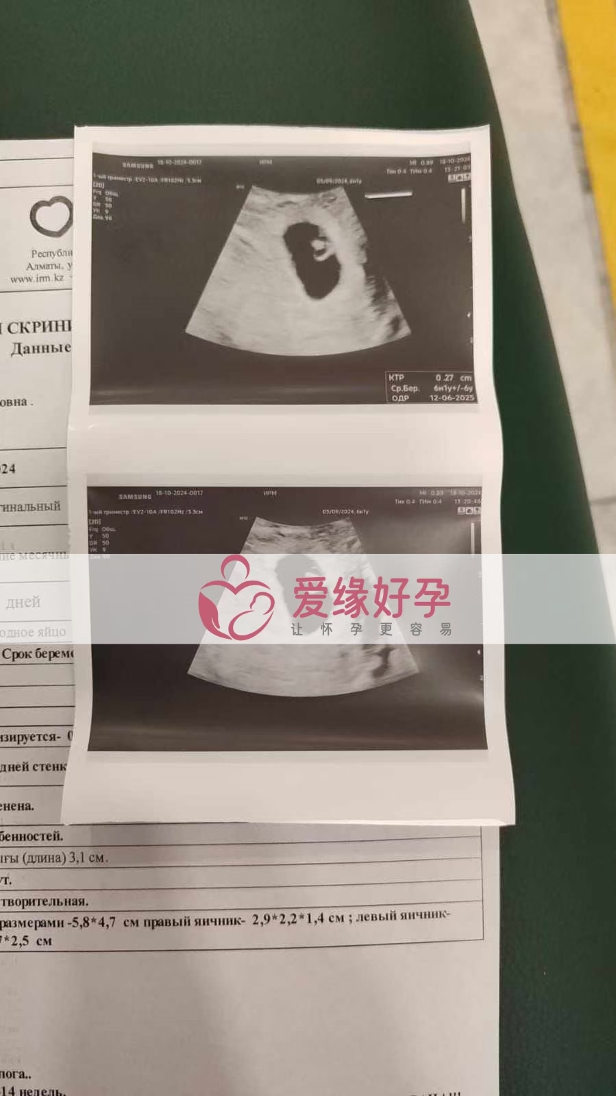 哈萨克斯坦代孕代母孕6周产检顺利通过