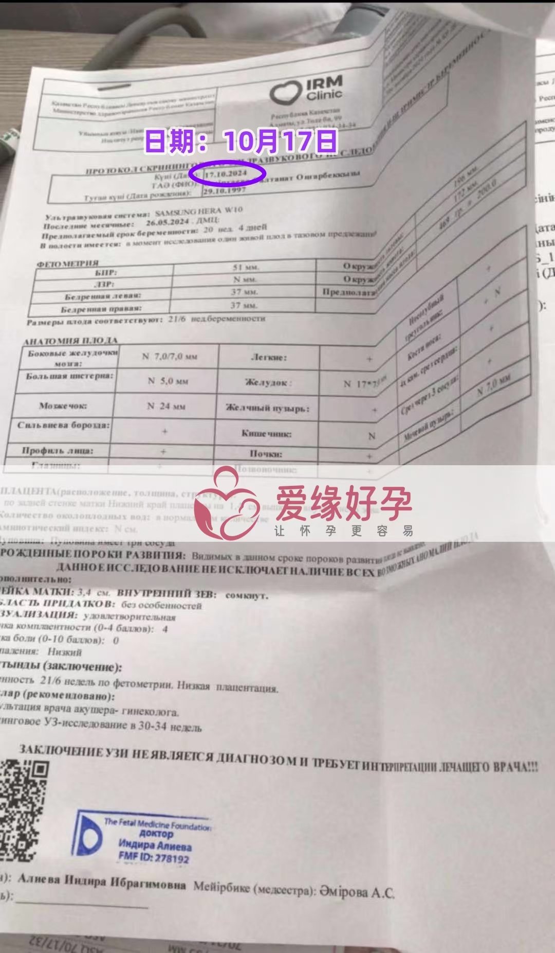 哈萨克斯坦代孕代母孕21周产检顺利通过