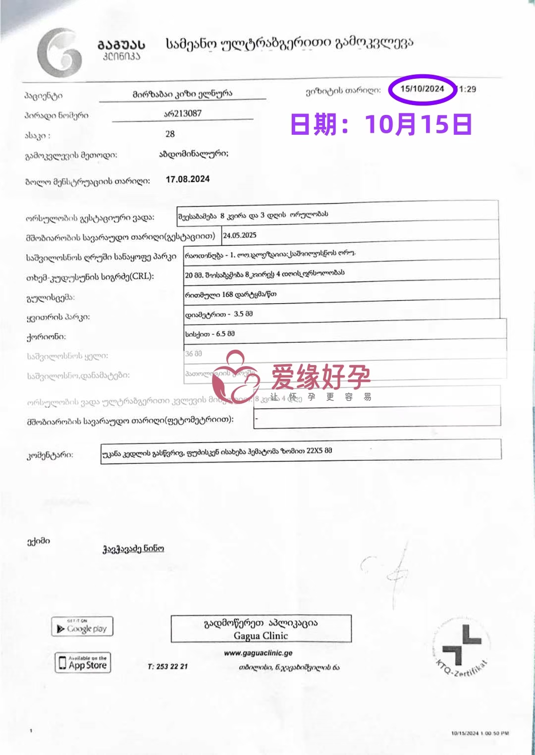 格鲁吉亚代孕代母孕8周产检顺利通过