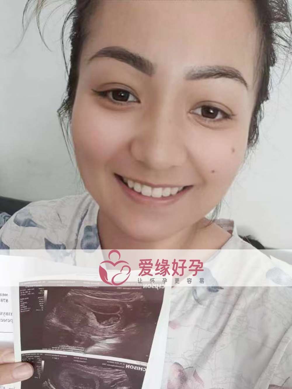 格鲁吉亚代孕代母孕8周产检顺利通过