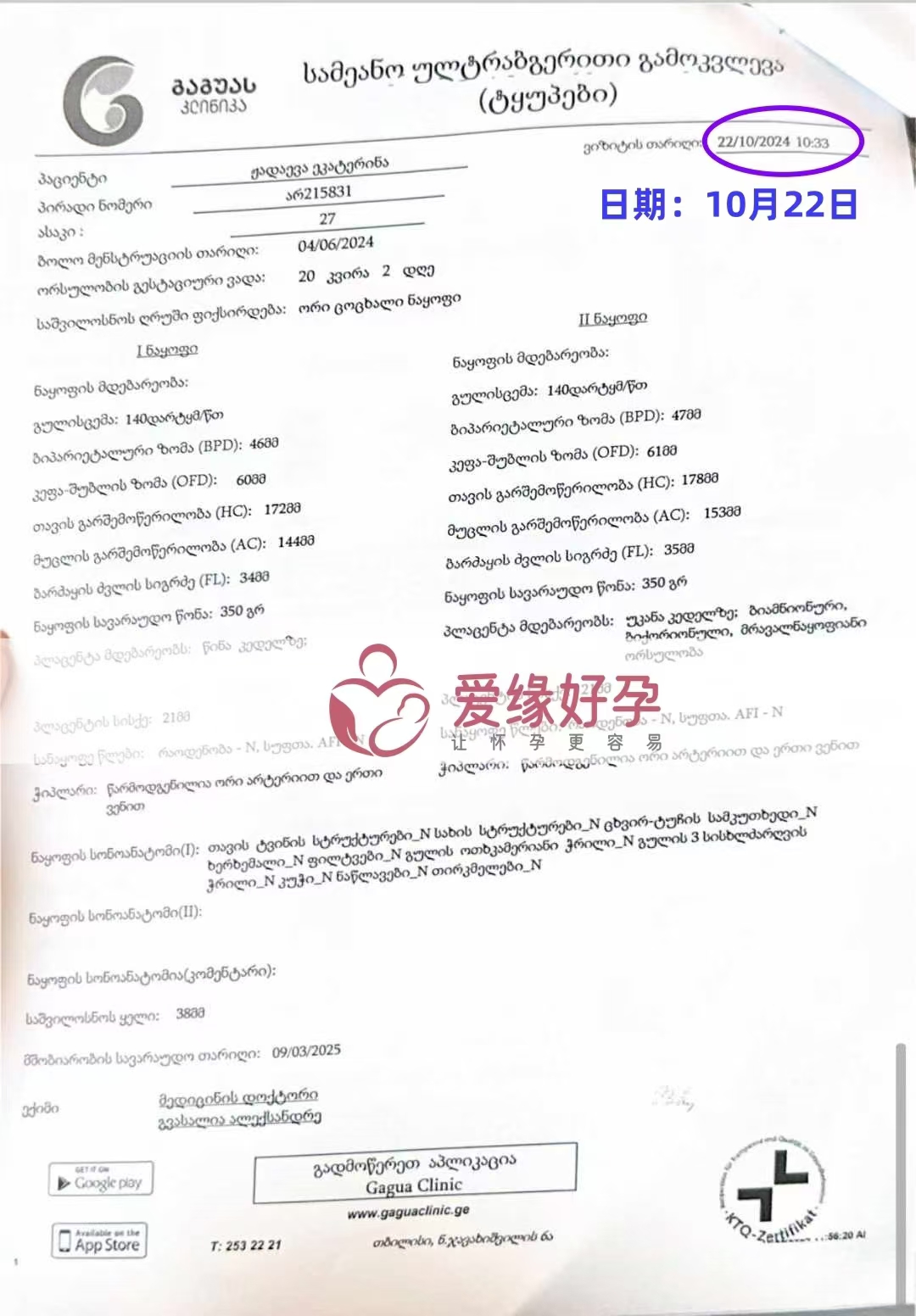 格鲁吉亚代孕代母孕20周产检顺利通过