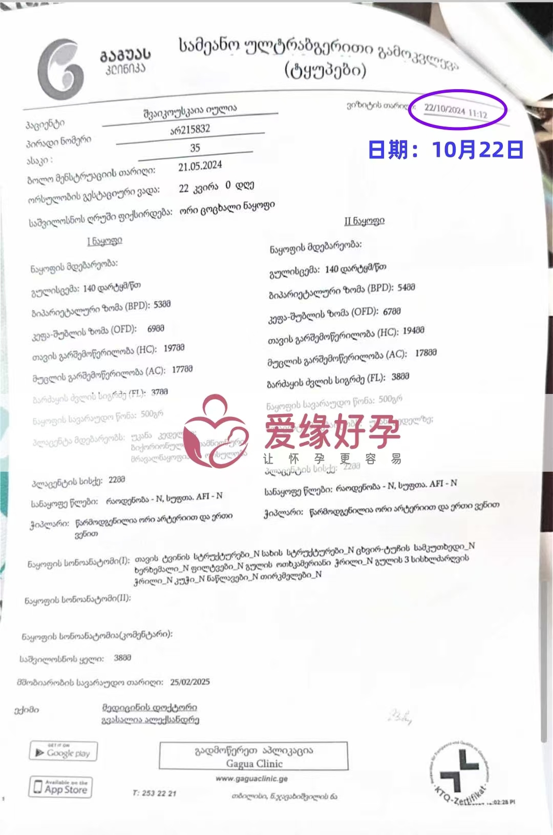 格鲁吉亚代孕代母孕22周产检顺利通过
