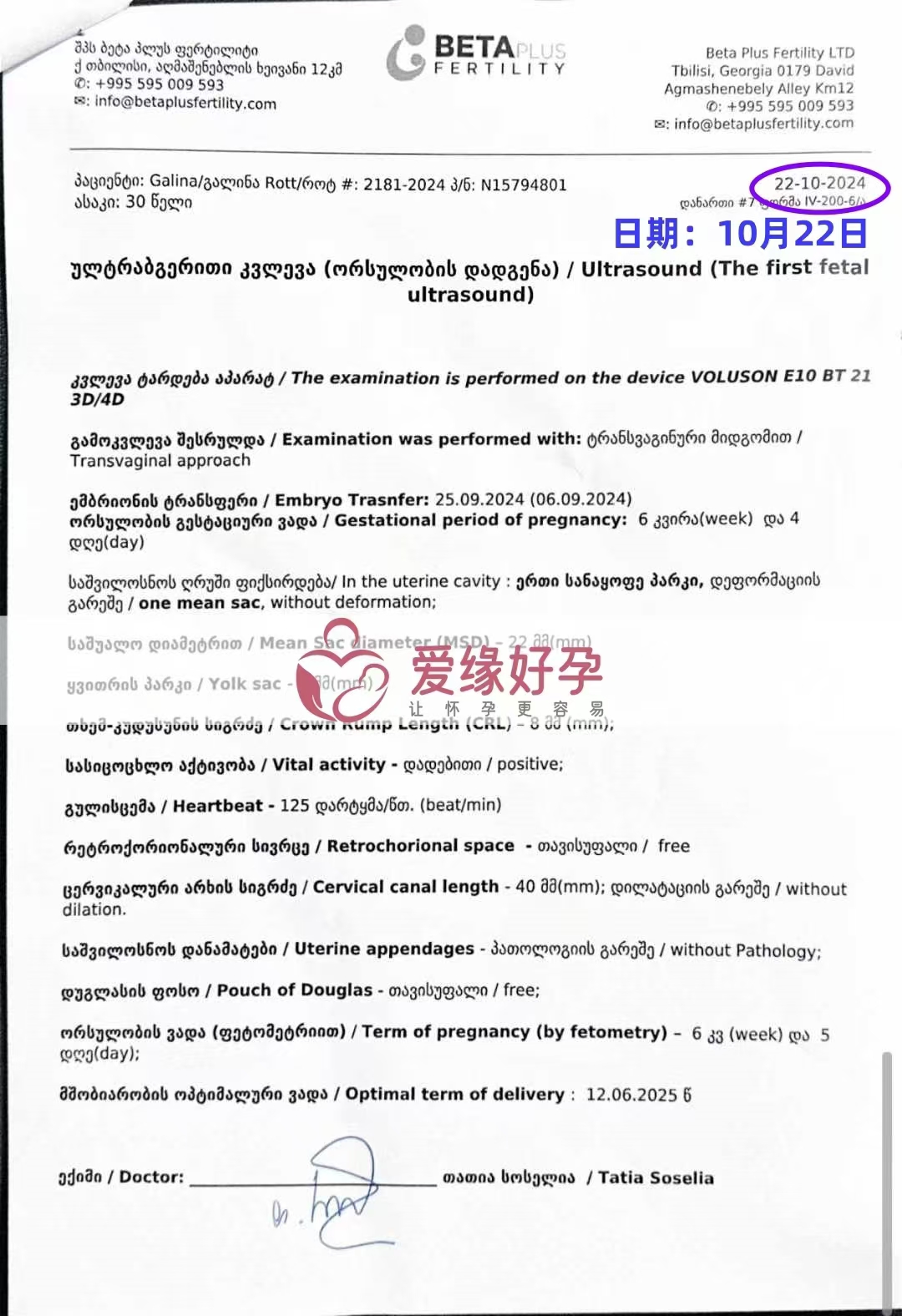格鲁吉亚代孕代母孕6周产检顺利通过