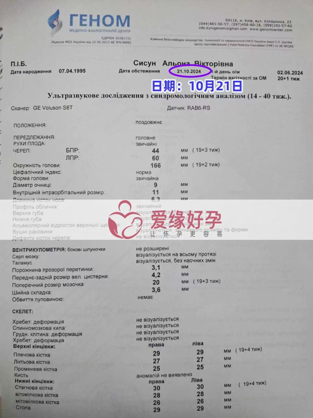乌克兰代孕代母孕19周产检顺利通过