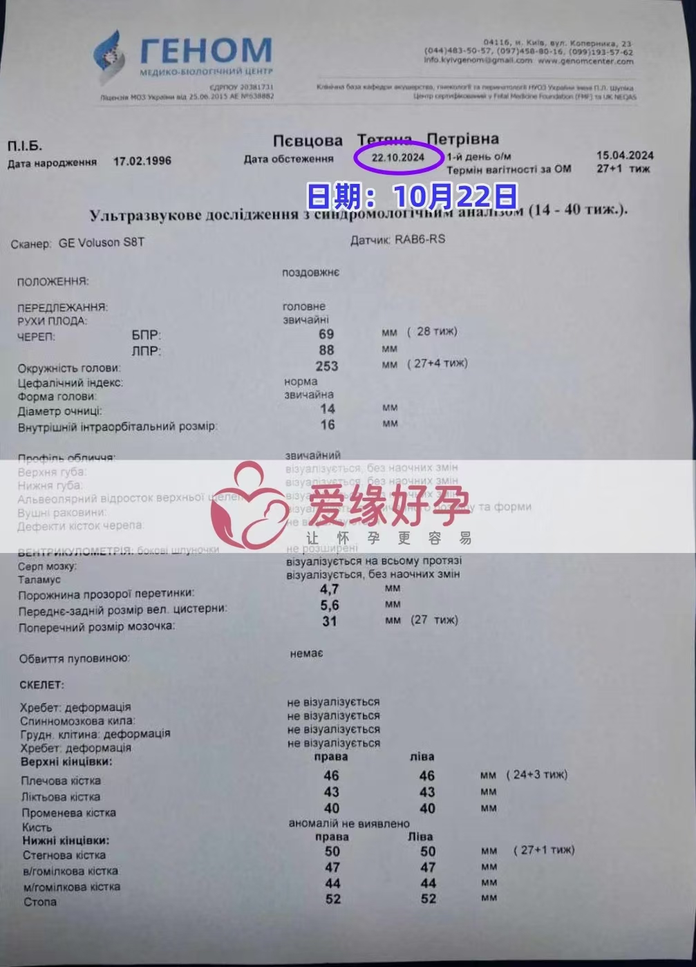 乌克兰代孕代母孕27周产检顺利通过
