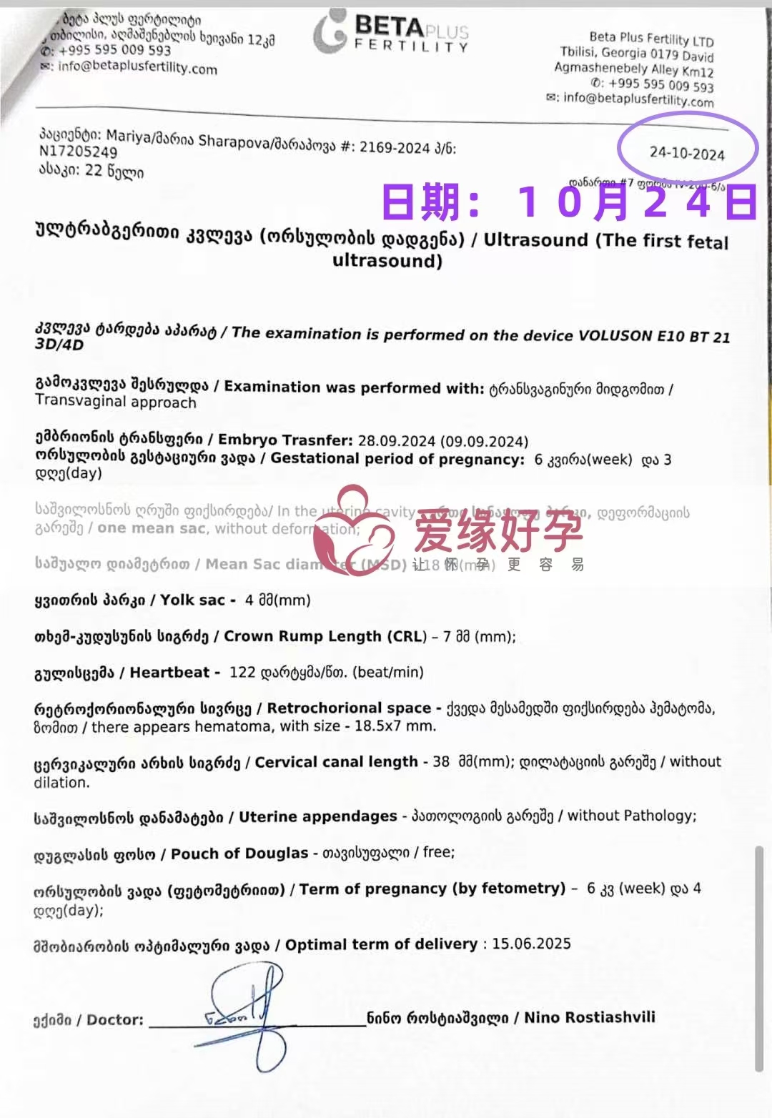 格鲁吉亚代孕代母孕6周产检顺利通过