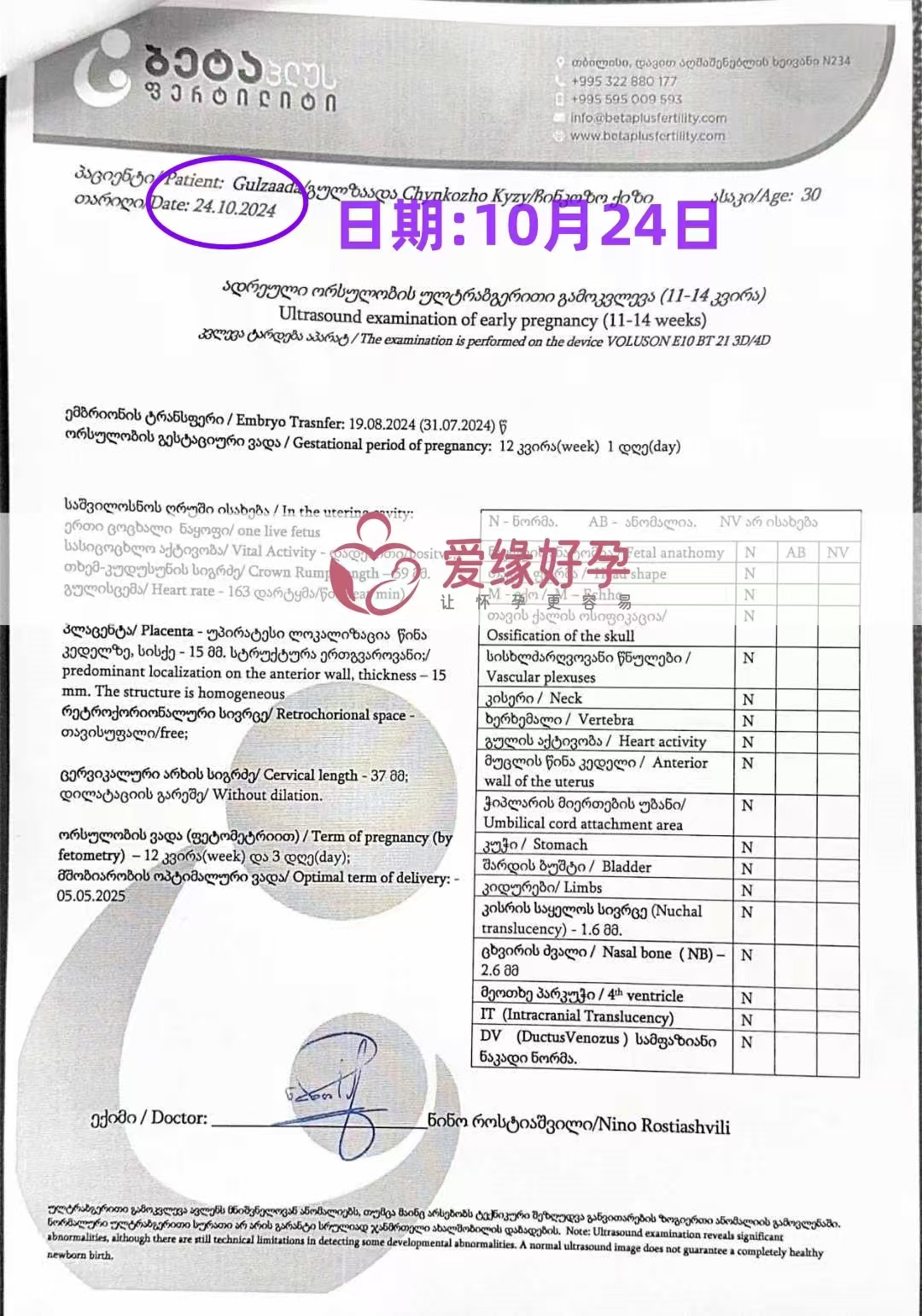 格鲁吉亚代孕代母孕12周产检顺利通过
