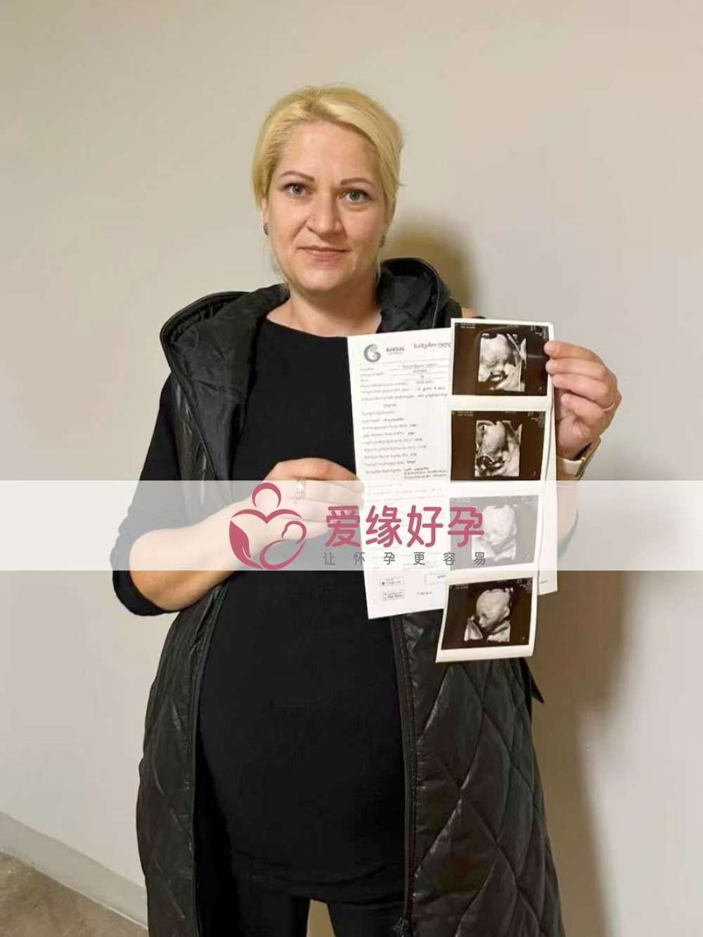 格鲁吉亚代孕代母孕22周产检顺利通过