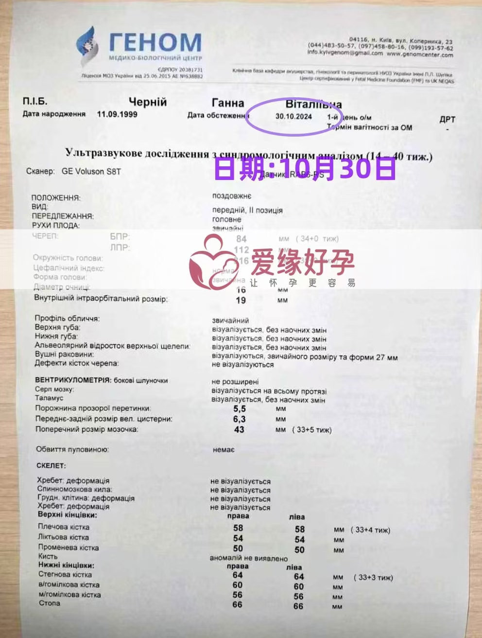 乌克兰代孕代母孕34周产检顺利通过