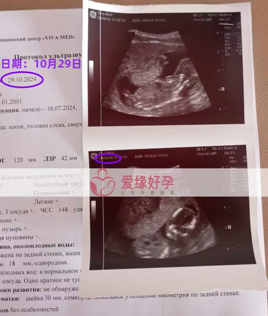 格鲁吉亚代孕代母孕15周产检顺利通过