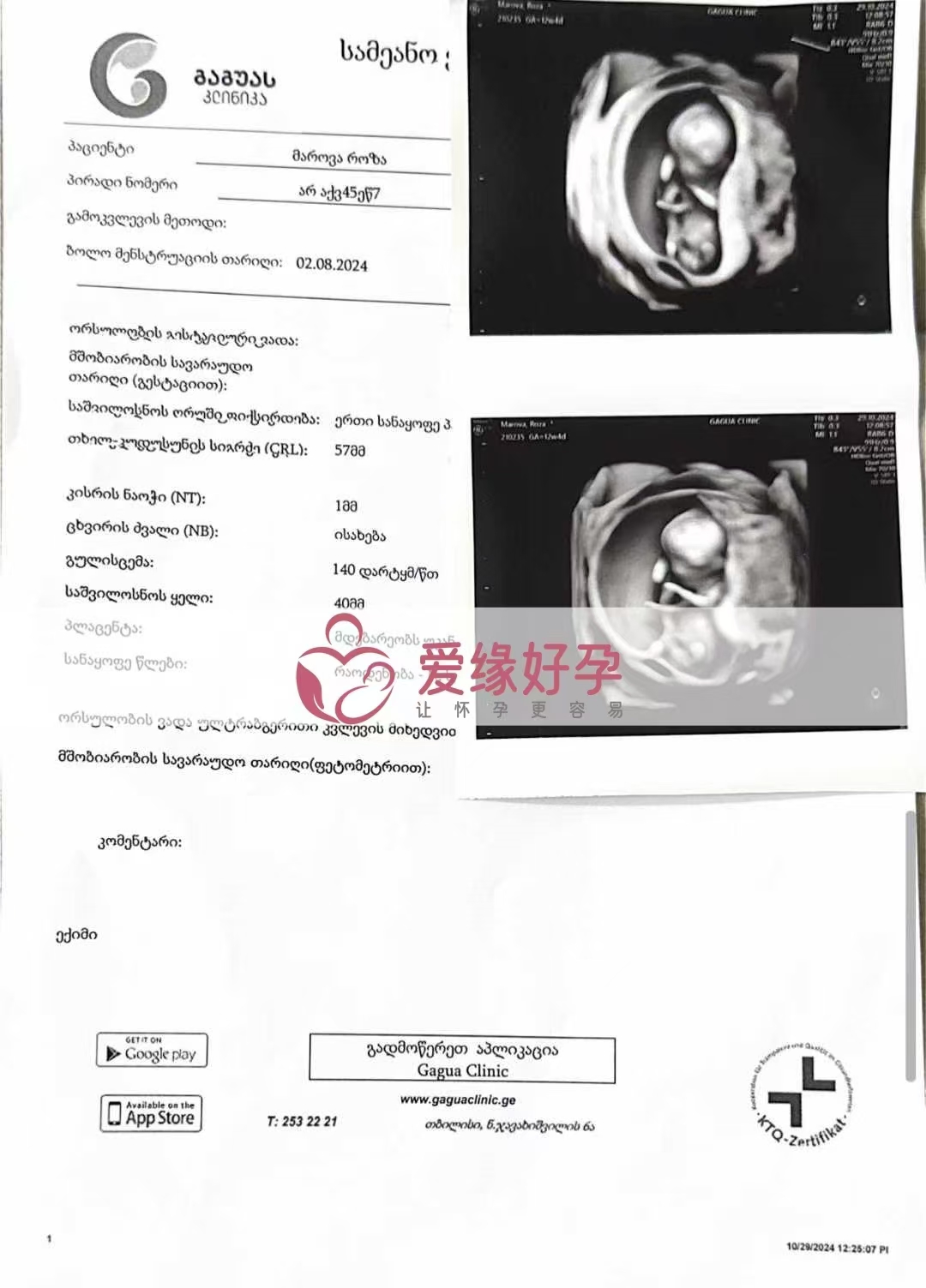 格鲁吉亚代孕代母孕12周产检顺利通过