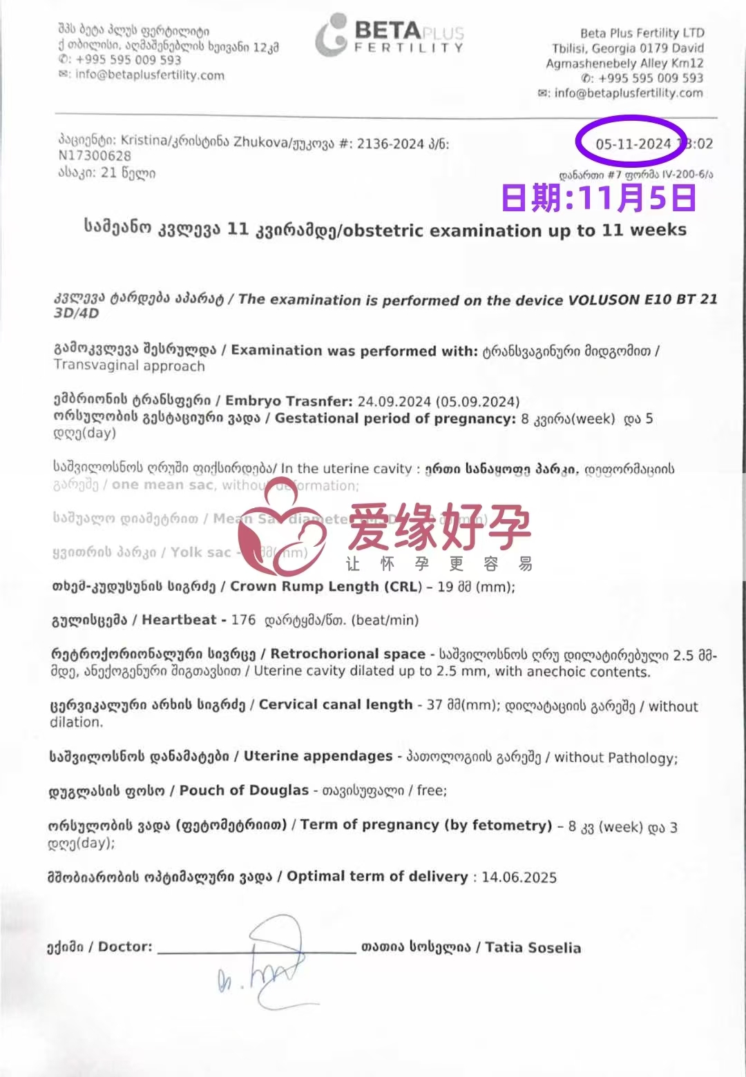 格鲁吉亚代孕代母孕8周产检顺利通过