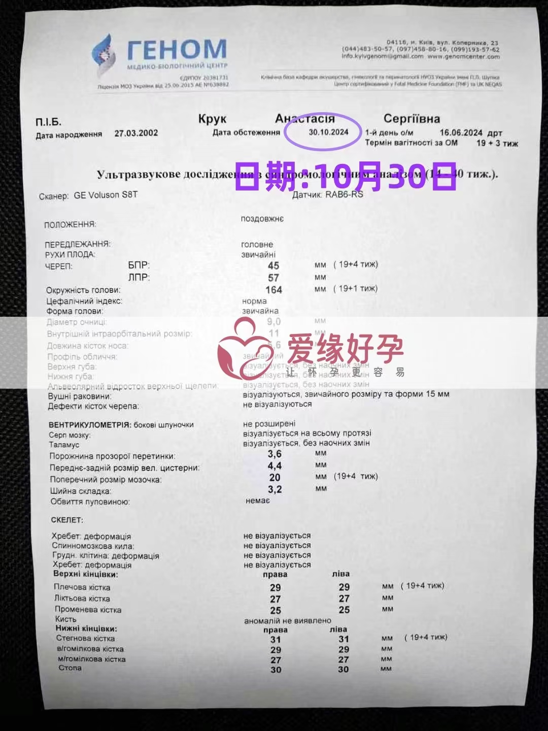 乌克兰代孕代母孕19周产检顺利通过