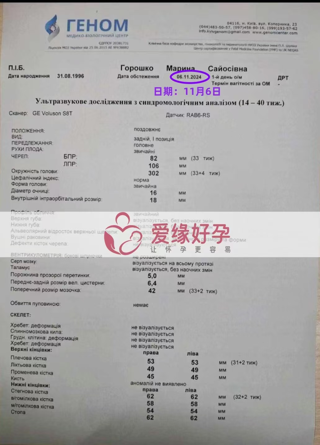 乌克兰代孕代母孕33周产检顺利通过