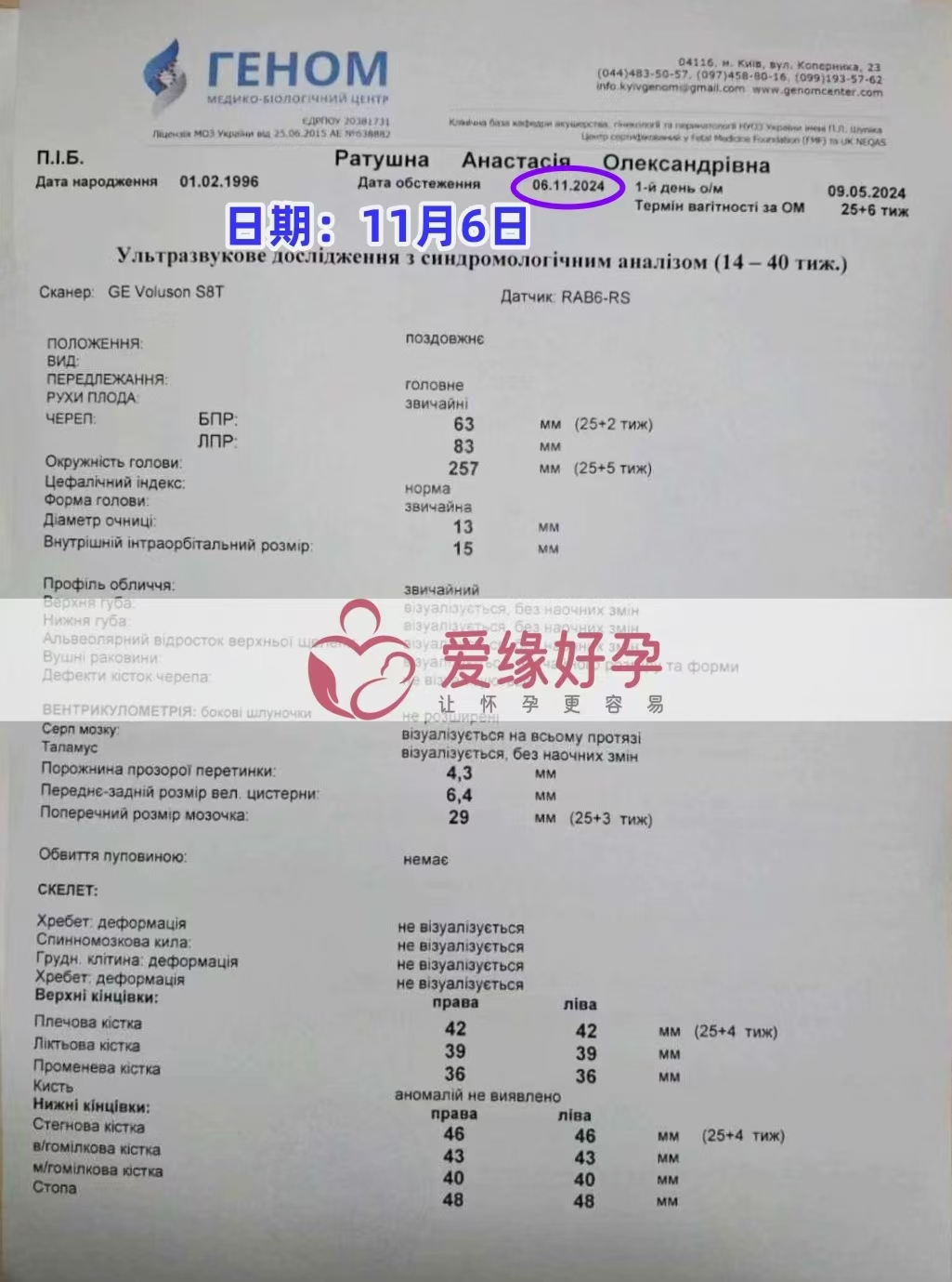 乌克兰代孕代母孕25周产检顺利通过