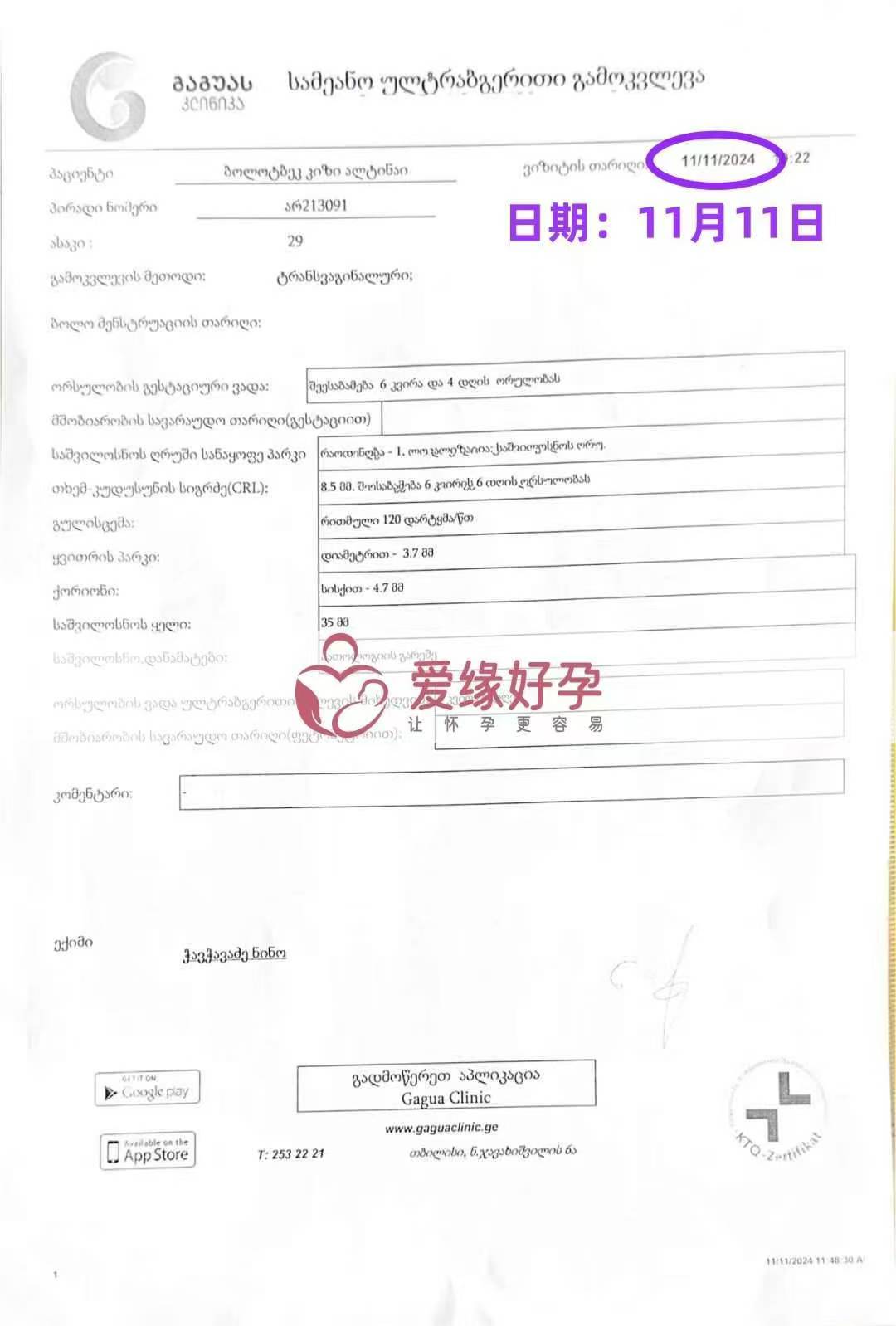 格鲁吉亚代孕代母孕6周产检顺利通过