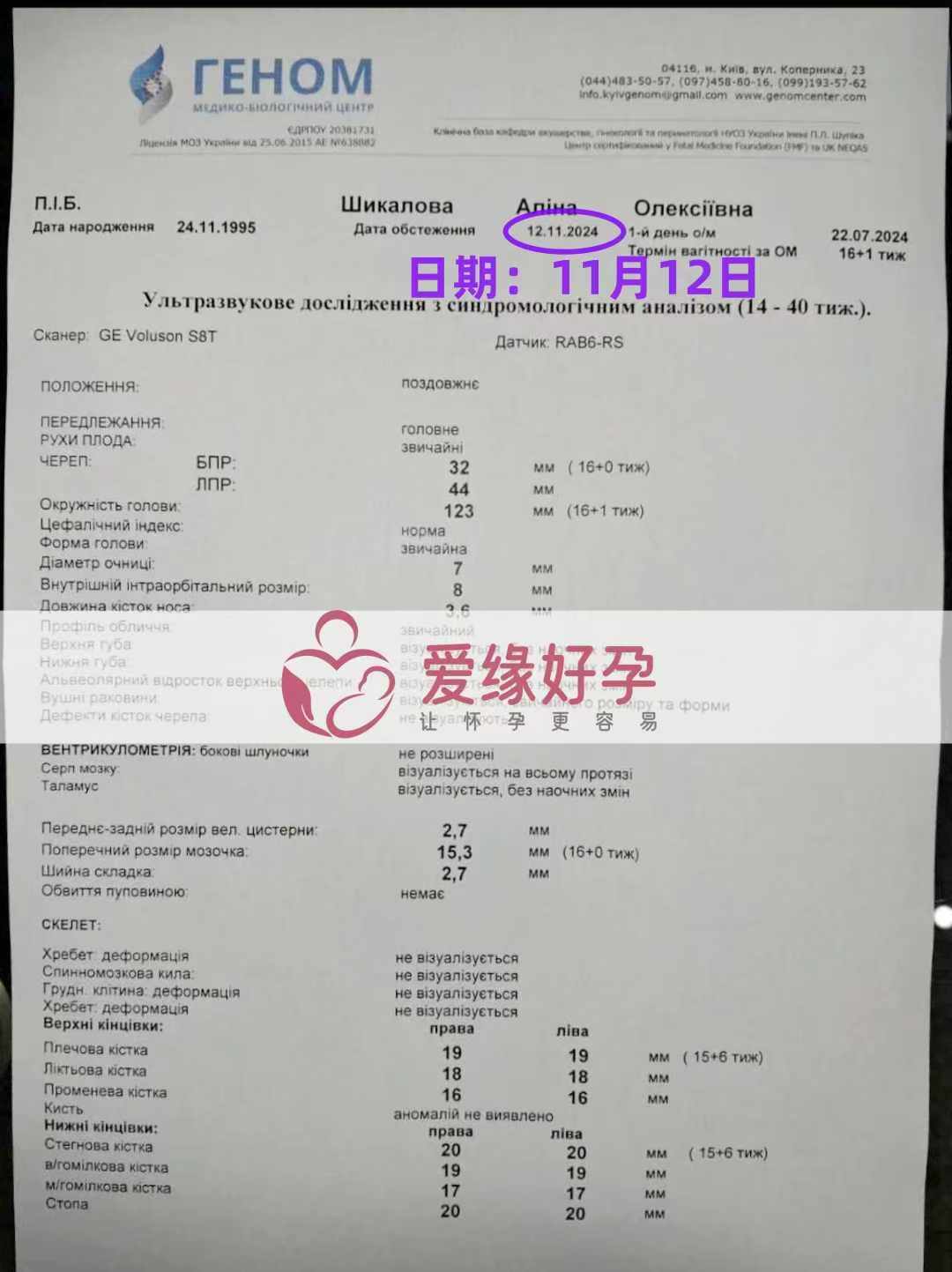 乌克兰代孕代母孕15周产检顺利通过