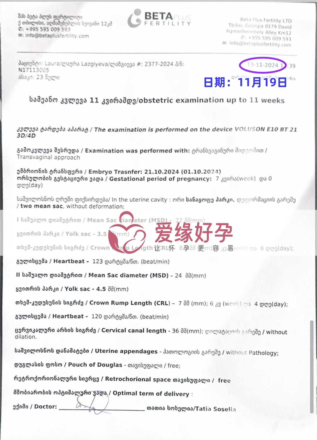 格鲁吉亚代孕代母双胎第一次B超顺利通过