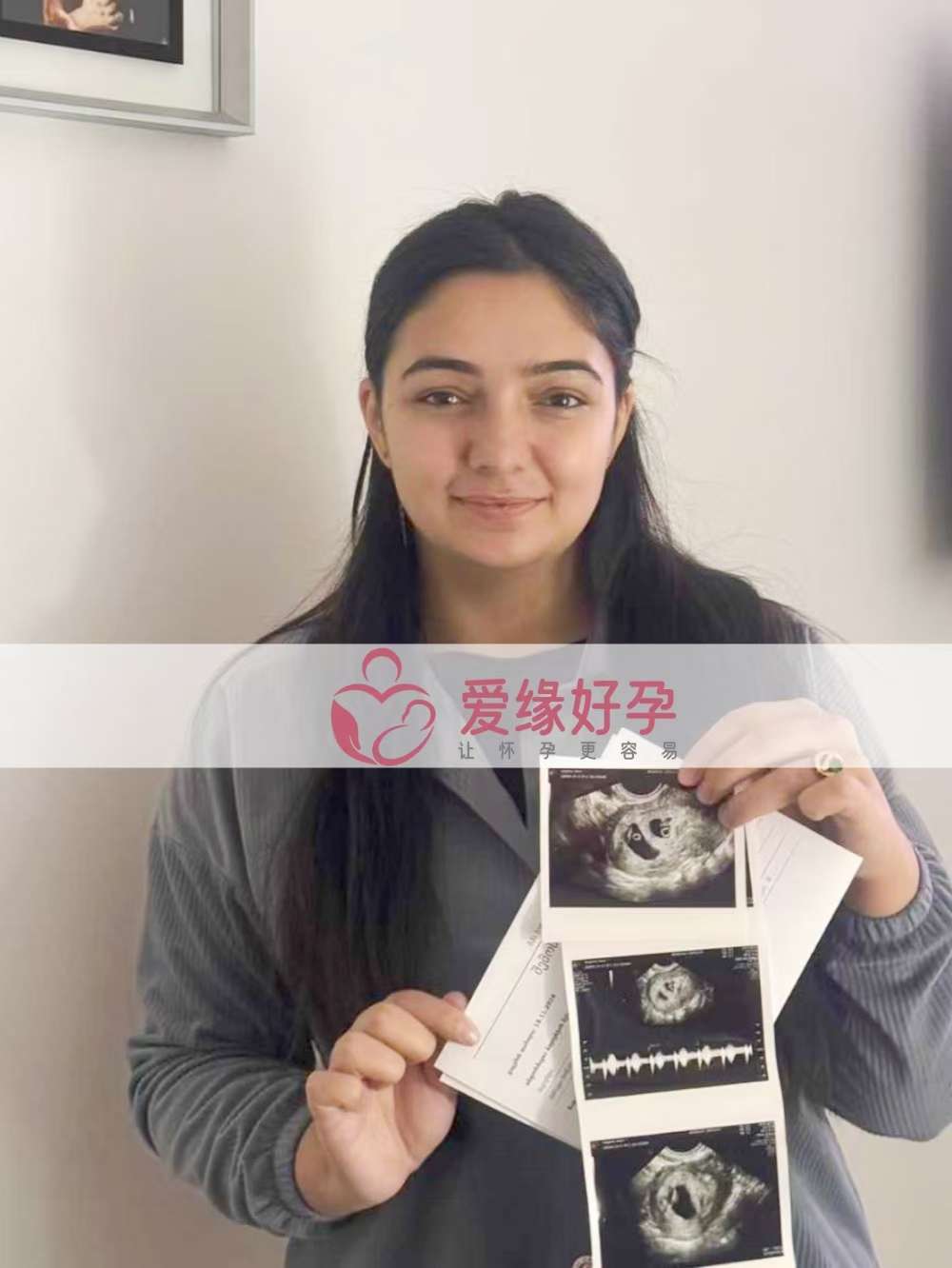 格鲁吉亚代孕代母双胎第一次B超顺利通过