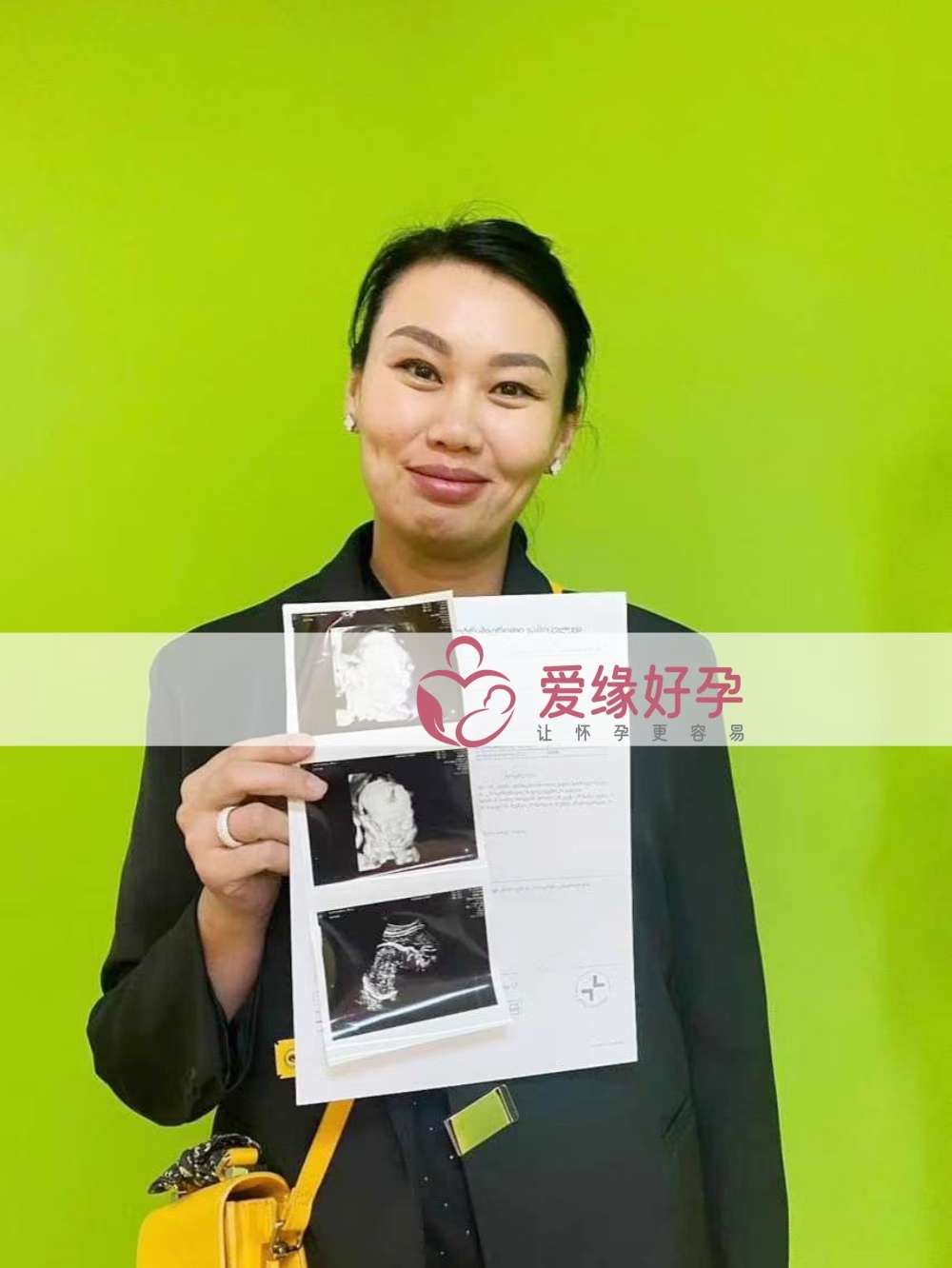 格鲁吉亚代孕代母孕29周产检顺利通过