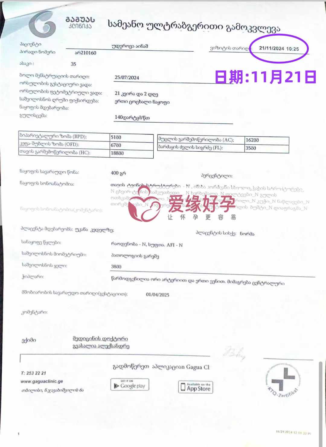 格鲁吉亚代孕代母孕21周产检通过