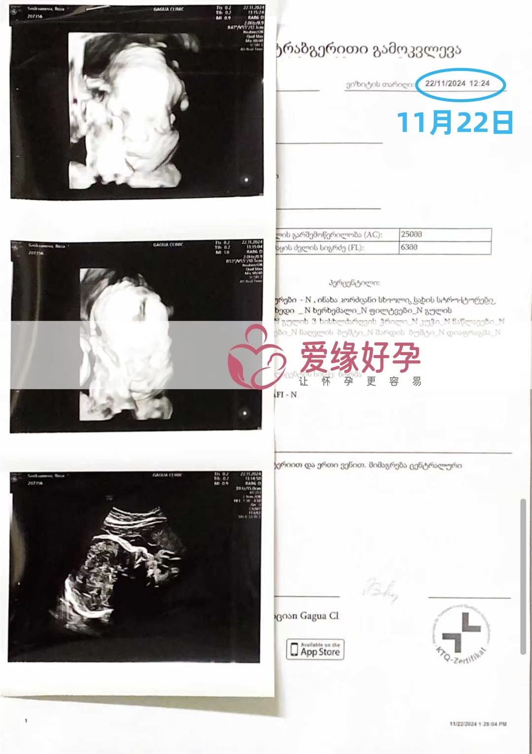 乌克兰代孕代母孕29周产检顺利通过