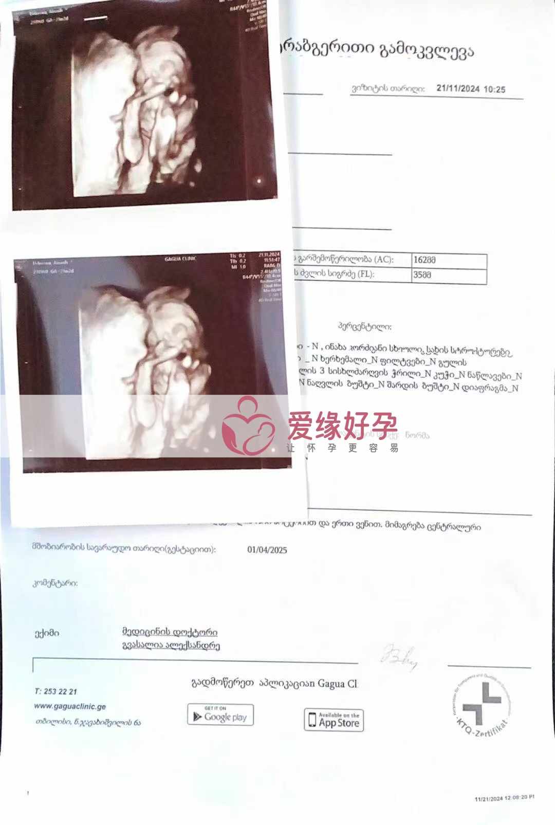 格鲁吉亚代孕代母孕21周产检通过