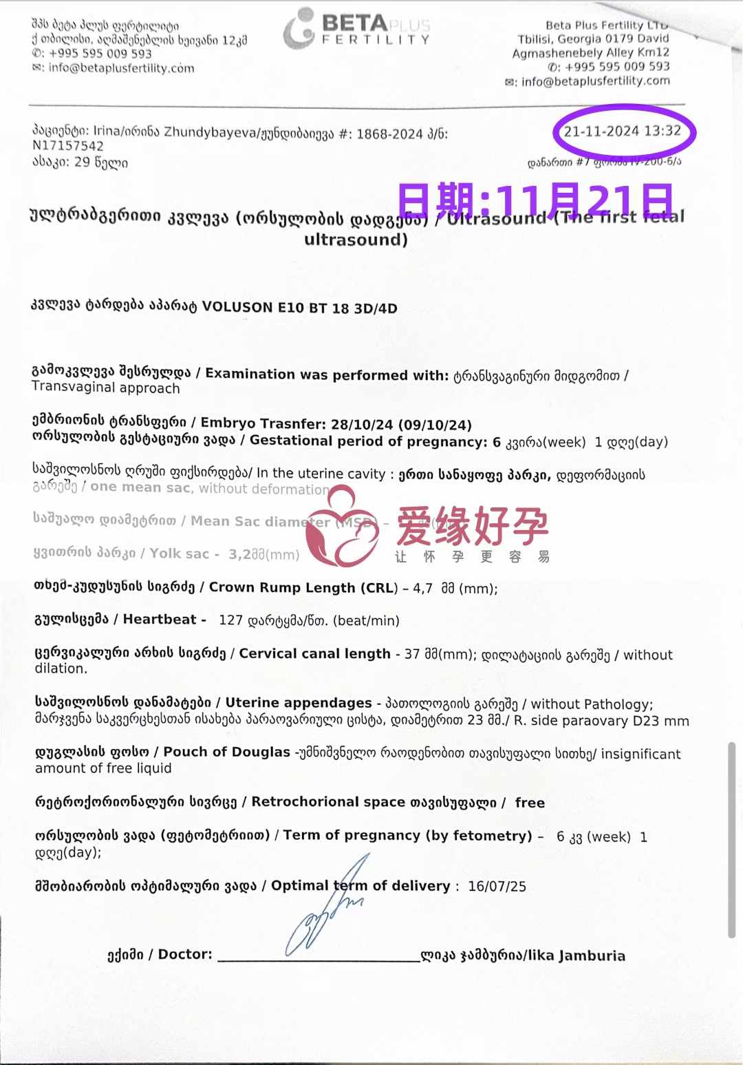 格鲁吉亚代孕代母孕6周产检通过