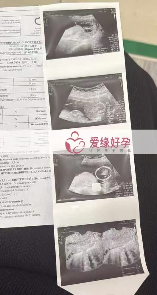 格鲁吉亚代孕代母孕16周产检顺利通过