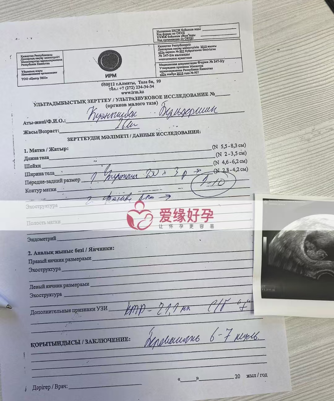 哈萨克斯坦代孕代母孕后2次B超检查顺利通过