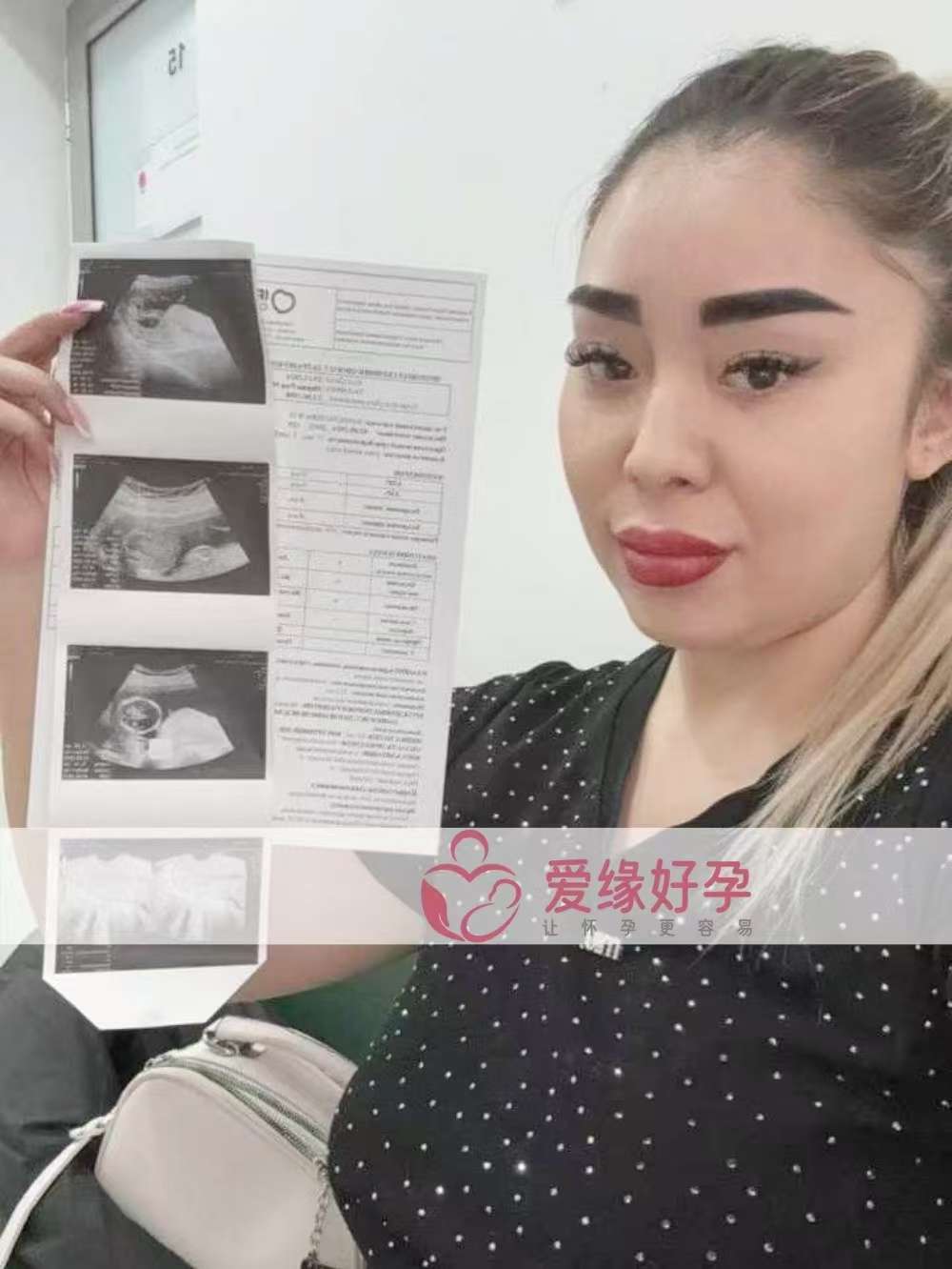 格鲁吉亚代孕代母孕16周产检顺利通过