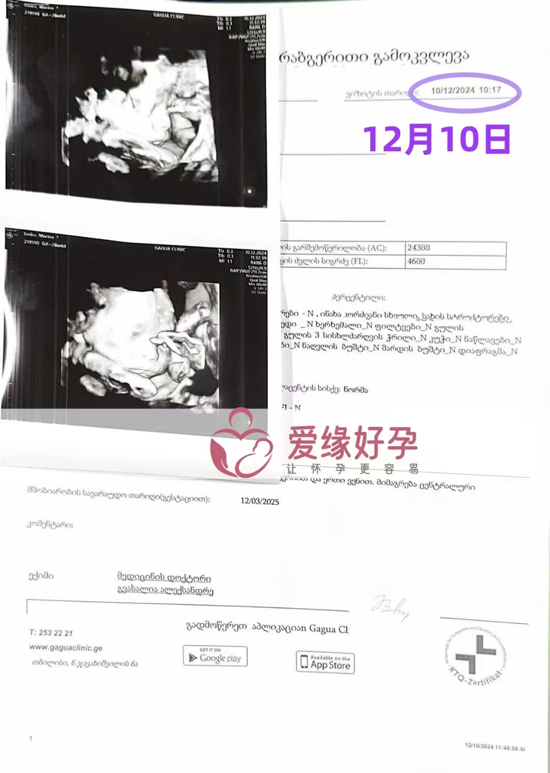 格鲁吉亚代孕代母孕26周产检