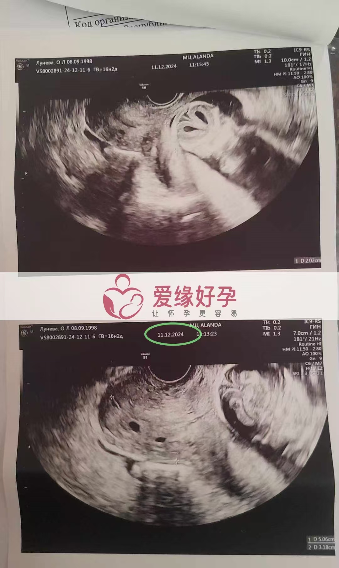 哈萨克斯坦代孕代母孕17周产检顺利通过