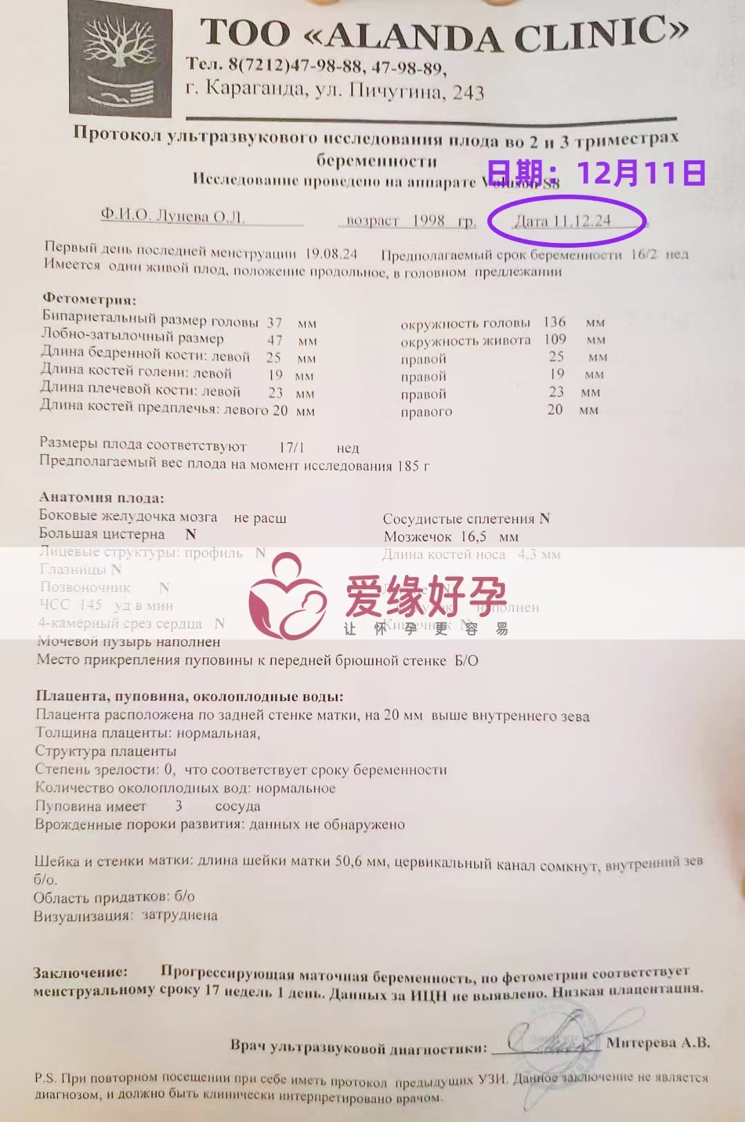 哈萨克斯坦代孕代母孕17周产检顺利通过